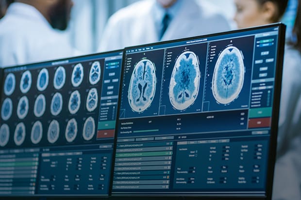 Two medical monitors in front of three doctors